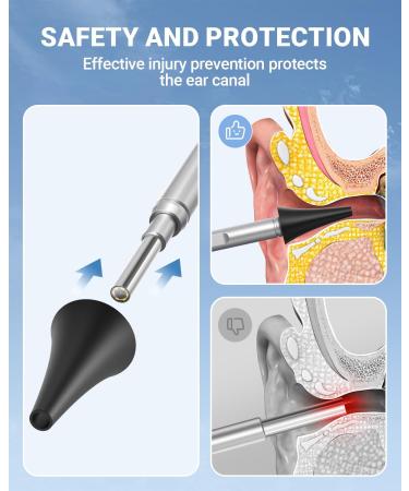 ScopeAround Ear Wax Removal Camera - 4.5 IPS Screen, 1920x1080 FHD Smart Visual Ear Cleaner - Plug & Play Home Ear Infection Detector & Remover - Buy Online on GoSupps.com