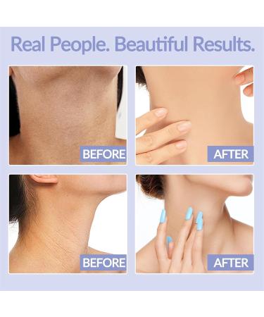 2024 New Neck Firming Cream | Tighten Lift & Hydrate Sagging Skin Shop Internationally - Buy Online on GoSupps.com