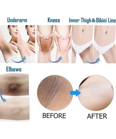 Gluta-C GLUTA C Gel blanchissant pour la peau des aisselles et du bikini 20 ml - Buy Online on GoSupps.com
