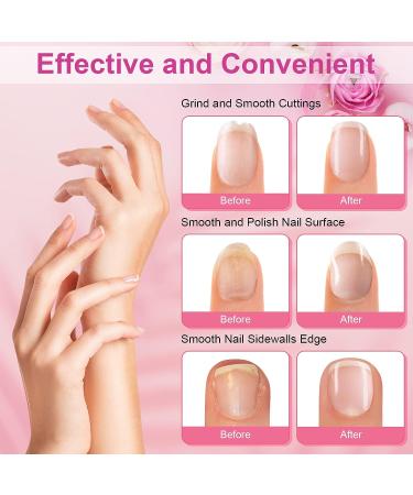 Linkax Electric Nail Drill and Grinder Kit - Portable Manicure Tools for Grooming and Polishing Nails at Home - Perfect Gifts for Women and Kids - Buy Online on GoSupps.com