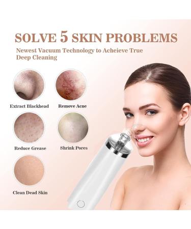 Luxury Confidence Keratin Remover Blackhead Remover Pore Vacuum Electric Face Vacuum Pore Cleaner White Heads Removal With 3 Modes And 4 Suction Heads Head Remover Creme (White One Size) 1 count (Pack of 1) White - Buy Online on GoSupps.com