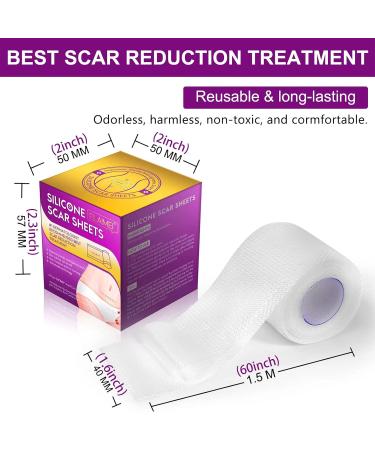 Silicone Scar Sheets | Clear Gel Tape for Surgical Scars, C-Section, Keloid, Burn, Acne | Softens and Repairs Scars | Washable | 1.6 x 60 - Buy Online on GoSupps.com