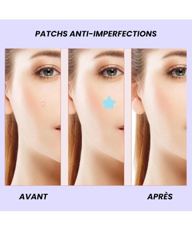Glama GlamUp Paris Antiimperfections patches Perfect Skin antipimples patch targeted care day and night fast and effective 28 pieces - Buy Online on GoSupps.com