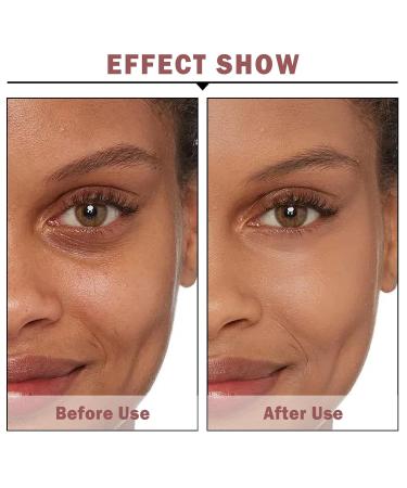 NVLEPTAP Eye Cream for Dark Circles Puffiness & Wrinkles - Reduce Bags & Fine Lines Firm & Lift Under-Eye Skin - Buy Online on GoSupps.com