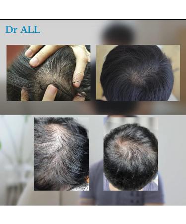 Dr.All Bio Scalp Shampoo for Hair Loss Prevention and Scalp Relief - 500ml | Paraben, Silicone, and Sulfate Free - Buy Online on GoSupps.com