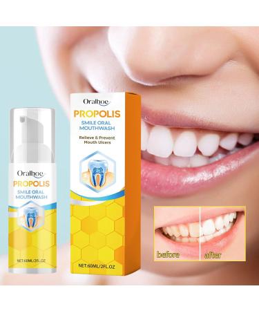Propolis Oral Instant Treatment Spray | Furzero Propolis Oral Health Spray & Teeth Total Care Mouthwash - Buy Online on GoSupps.com