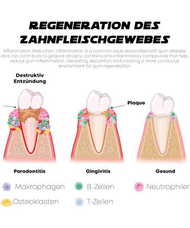  ALLILUYAA Pack of 3 periodontal treatment gels for immediate gum treatment and restoration - Buy Online on GoSupps.com