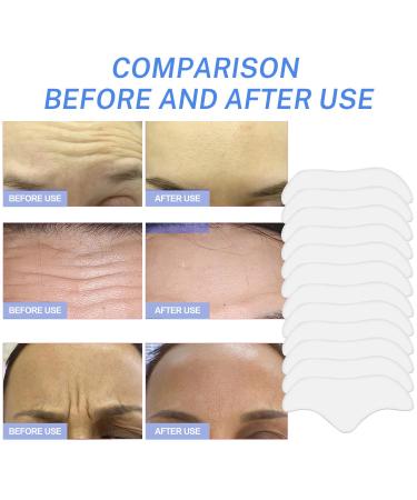 Forehead Wrinkle Patches - Anti-Wrinkle Hydrolyzed Collagen & Vitamin E Face Tape (24PC) for Youthful Skin - Buy Online on GoSupps.com