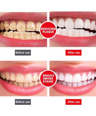 Fivfivgo 4TM Probiotic Whitening Toothpaste - Yayashi SP-4 Lightening Formula (A+B) | International Shipping - Buy Online on GoSupps.com