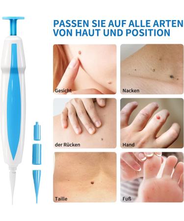 Fast & Painless Wart Remover Kit - 2 in 1 Skin Tag Remover for 2mm-8mm | Effective International Shipping - Buy Online on GoSupps.com