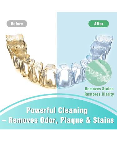 JOYAONE Retainer Cleaning Tablets 36 Tablets Monthly Pack Denture Cleaning Tablets Mint Fresh Mouth Cleaner for Retainer Aligner Mouth Guard Night Splints and Dentures - Buy Online on GoSupps.com