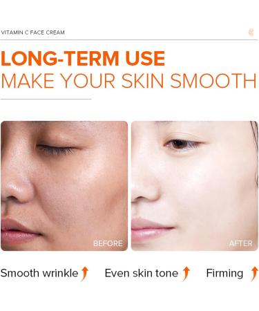 Vitamin C Moisturiser For Face Cream Anti Aging & Wrinkle Day And Night Face Cream For Women & Men Brighten & Even Skin Tone Boost Skin Collagen Reduce Fine Lines for Skin Care - Buy Online on GoSupps.com