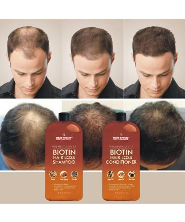 Hair Growth Shampoo Conditioner Set - Anti Hair Loss Biotin with DHT Blockers | For Men and Women | All Hair Types | Sulfate-Free - 2 x 16 fl oz Ginger - Buy Online on GoSupps.com