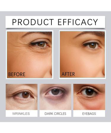  JASUBAI Retinol eye cream for dark circles and puffiness anti-aging under-eye cream with caffeine and hyaluronic acid brightening and deep skin hydration (2) - Buy Online on GoSupps.com