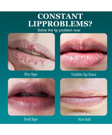 Cerise Masque de collag ne No l Masque Levre No l Soins pour les L vres Nourrit et hydrate Am liore la s cheresse et la rugosit Apaise les l vres gerc es Nuit Jour - Buy Online on GoSupps.com