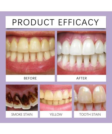 KLYso Professional-Grade Whitening Toothpaste - Removes Stains Enhances Shine & Freshens Breath!(3PCS) - Buy Online on GoSupps.com