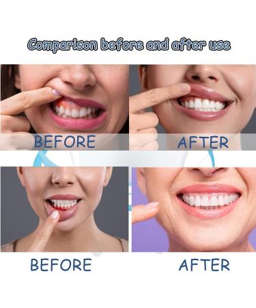 Spray Contre les Maux de Dents Soulagement Instantan des Maux de Dents Spray de Soulagement de la Douleur Dentaire R paration des Gencives 20ML 1PC - Buy Online on GoSupps.com