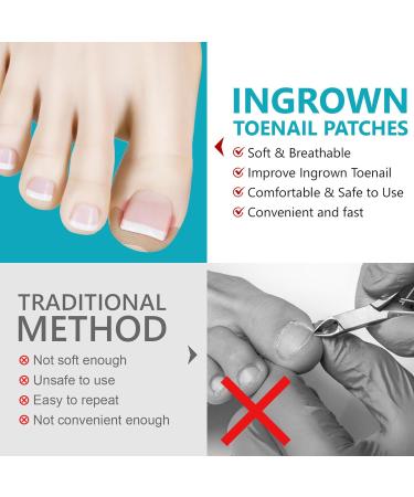 Ingrown Toenail Patch Ingrown Toenail Corrector | Toenail Repair to Relieve Nail Groove Nail Correction Patches Suitable for Men Women and Elderly Adern - Buy Online on GoSupps.com