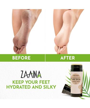 Heel Balm Stick 100% Natural | Miracle Foot Cream for Fast Relief | Intensive Moisturizing Foot Care Therapy | For Dry Cracked Heels & More | 2 Ounce by ZAAINA - Buy Online on GoSupps.com