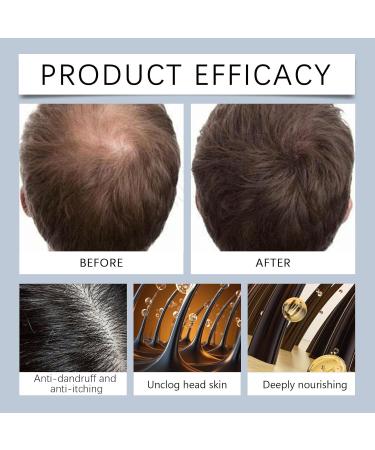  homomdy Hair Care Roll-On Serum for Men Hair Nourishing Serum Strengthening Soothing and Moisturizing Natural Formula for Thicker and Strong Hair Lightweight and Non-Greasy (1pcs) - Buy Online on GoSupps.com
