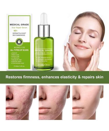 Goopgen Advanced Scar Repair Serum - Medical Grade Nature Treatment for All Types of Scars (Color 5pc) - Buy Online on GoSupps.com