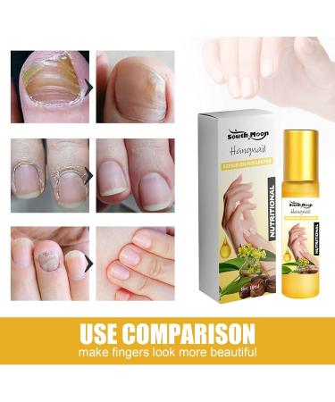 Nail Cuticle Oil Organic Cuticle Oil for Nails Nail Repair Oil Repair Dry Cracked Nails & Rigid Cuticles Deep Moisture for Nails and Cuticles Smooth Barbs Care for Nail Edges 10ml - Buy Online on GoSupps.com