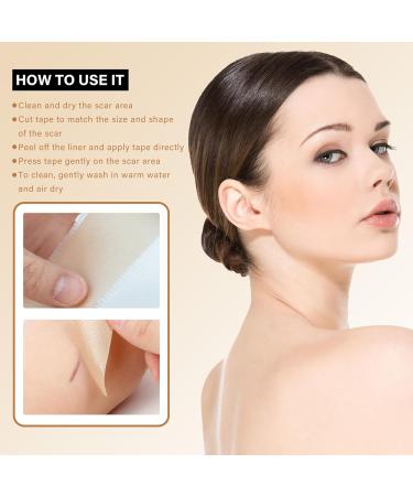 Medical Grade Silicone Scar Tape - 164x1.57 Roll for Scar Removal | C-Section Tummy Tuck Keloid & Surgical Scars | Reusable Silicone Scar Sheets - Buy Online on GoSupps.com