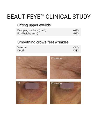 Plumping Mineral Eye Cream with Rose Hip Fruit Oil - Hydrate & Revitalize Your Eyes | International Shipping - Buy Online on GoSupps.com