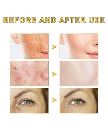 2PCS Snail 96 Mucin Power Essence 100mL - Skin Care Serum with Snail Secret Mucin - Buy Online on GoSupps.com