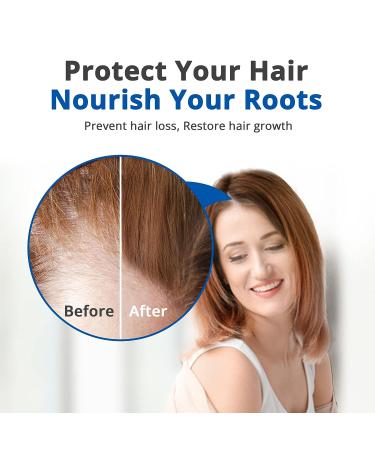HAIRMETTO Saw Palmetto Hair Serum | Promotes Hair Regrowth, Soothes Scalp | Non-Oily, Peppermint Scent -118 mL - Buy Online on GoSupps.com