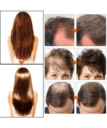 Natural Hair Growth Shampoo for Thicker, Fuller Hair - Organic Hair Loss Treatment - 7.43 Fl Oz - Buy Online on GoSupps.com