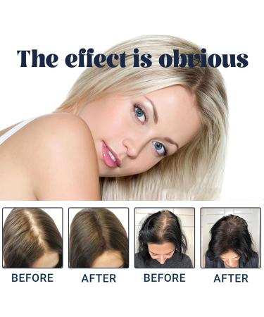 Nordicbiolabs Stem Cell Complete Hair Cycle S rum Ampoule Capillaire S rum NordicBiolabs Stem Cells & Multi-peptides Ampoules R paratrices Profondes R pare Et Donne Du Volume (28 pi ces) - Buy Online on GoSupps.com