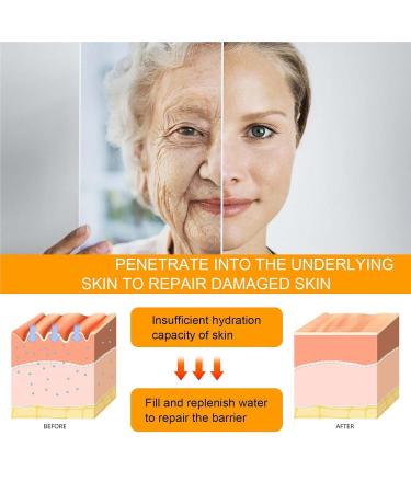 WUEOCU Beauty Crema De Ojos Con P ptidos 5D Crema De Ojos Con Peptido 5D Peptide Eye Cream Eye Cream Anti Aging For Dark Circles And Puffiness Skin Under Eyes Moisturize (2PC) - Buy Online on GoSupps.com