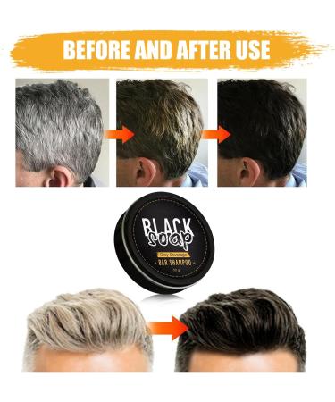  MagiSel Polygonum Multiflorum Shampoo natural Polygonum for black and thick hair anti-hair loss promotes hair growth and prevents hair loss - Buy Online on GoSupps.com