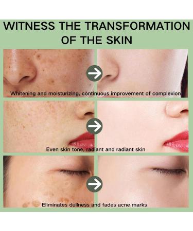 Dark Spot Remover for Face - Repair Face Cream - Face Cream for Women - Face Moisturiser for Dark Spot Correcting - Moisturizing and Anti-Blemish Spot Cream (30g) - Buy Online on GoSupps.com