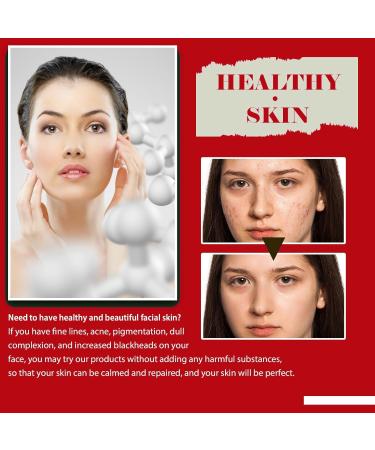 100% Organic Rose Seed Oil Rosehip Oil for Face Rose Essential Oil Body Oil for Women Anti Aging Serum for Face Organic Rosehip Oil Rose Hip Oil for Skin Rosehip Seed Oil for Face Skin Hair Nails - Buy Online on GoSupps.com