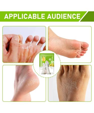 Horktrust Peeling mask for dry and cracked feet with lactic acid and olive oil removes calluses and dead skin in 27 days treatment for men and women - Buy Online on GoSupps.com