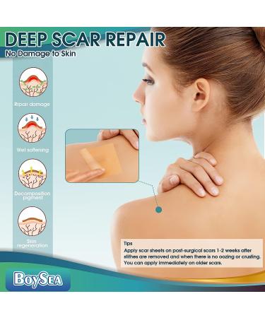 Silicone Scar Sheets Roll - 1.6 x 120 - 3M Clear Scar Tape for Scars Removal - Reusable Strips for Keloid, C-Section, Surgery, Burn, Acne - Elastic Bandage Treatment - Buy Online on GoSupps.com