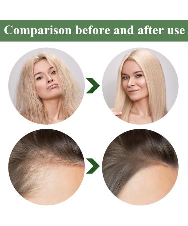 WUSANNA Organic Batana Oil for Hair Growth Organic Batana Oil for Hair Batana Oil Organic for Growth Hair Rosemary Oil Hair Pure Organic Natural and Cold Pressed Hair Oil (100 ml) - Buy Online on GoSupps.com