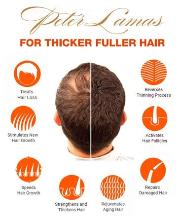 Peter Lamas Biotin Regrowth Shampoo | Apple Stem Cell & Vitamin B Formula for Fuller Hair | Reduce Scalp Irritation & DHT Buildup - Buy Online on GoSupps.com