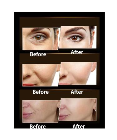 VJPPII Hyaluronic Acid Active Peptide Anti-Wrinkle Cream Collagen Hyaluronic Acid Face Cream (1PC) - Buy Online on GoSupps.com