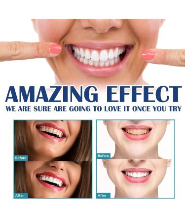 Teeth Whitening Paint 5ml - Oral Cleaning for Stains & Yellow Teeth - Whitens & Beautifies - One Size (White) - Buy Online on GoSupps.com