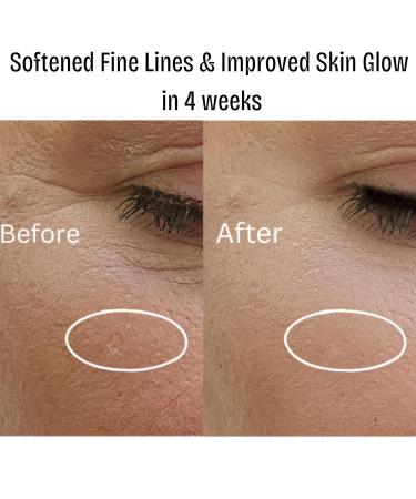 SNAYKAA Face Moisturizer for Dry & Sensitive Skin Hydrating Face Cream with Niacinamide Hyaluronic Acid Peptides & Squalane Lightweight Daily Moisturizer Made in USA (1.76 fl oz) - Buy Online on GoSupps.com