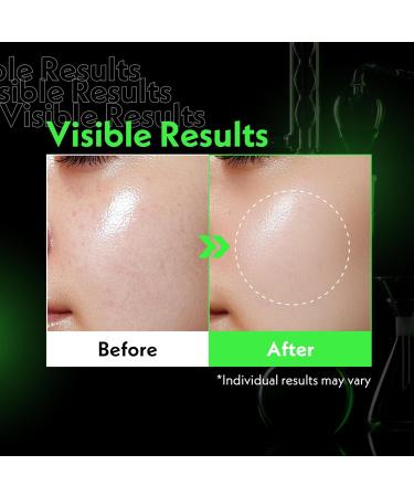 NOSCA9 Bestsellers Skincare Set Deep Pore Cleanser Calming Serum & Soothing Cream with Centella Asiatica Amino Acids Ceramides & White Clay Korean Skincare for Sensitive Skin - Buy Online on GoSupps.com