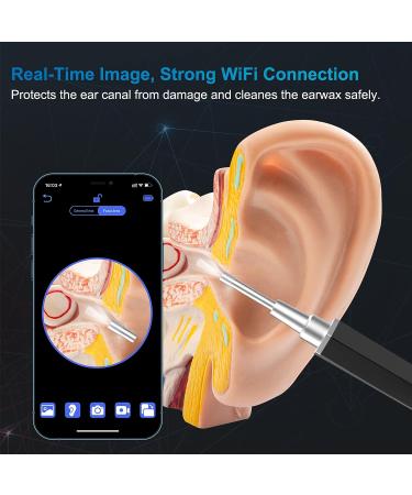 Ear Wax Removal Camera Kit with Light and 6 Ear Spoons - Ear Cleaner and Otoscope Tool for Kids, Adults, and Pets - Buy Online on GoSupps.com