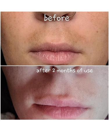 Dark Spot Corrector & Brightening Serum with Kojic Acid, Vitamin C, Salicylic Acid & More | Melasma Treatment Cream by Admire My Skin - Buy Online on GoSupps.com