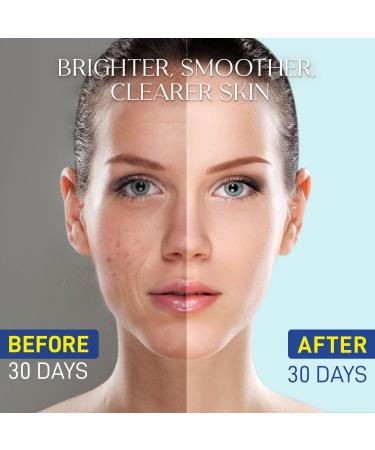 Niacinamide Serum 15% for Face Dark Spot Corrector Pore Minimizer Oil & Blemish Control Brightening & Hydrating with Vitamin C B5 Peptides & Hyaluronic Acid 1.7 Fl Oz 1.7 Fl Oz (Pack of 1) Cerulean - Buy Online on GoSupps.com