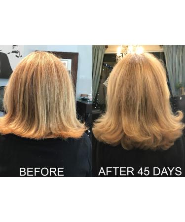 Biotin Hair Growth Conditioner - High Potency Anti Hair Loss Treatment with Vitamins E, A, and C - 8.5 Ounce - Buy Online on GoSupps.com