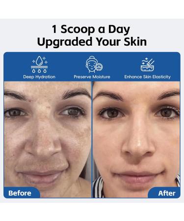 Arofum Hyaluronic Acid Powder, with Collagen Peptides DIY Hydrating Serum & Skincare Ingredient, Clean Formula, Gluten-Free, No Preservatives 100g / 3.52oz - Buy Online on GoSupps.com