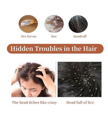 Milltrip Stainless Steel Fine Tooth Comb - Lice Flea & Dandruff Removal for Pets and Humans - Professional Grooming Tool - 1 PC - Buy Online on GoSupps.com